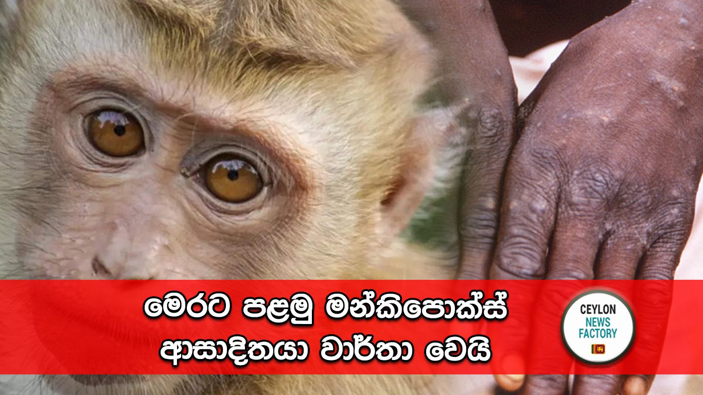මන්කිපොක්ස්