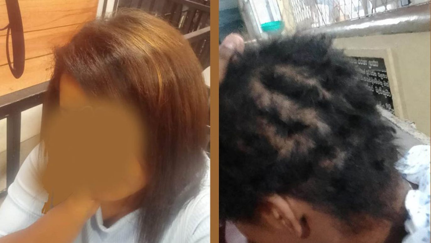 Hair